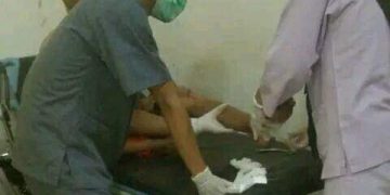 Aksi Geng Motor Kembali Berulah, Melukai Pedagang Nasi Goreng Di Sukabumi