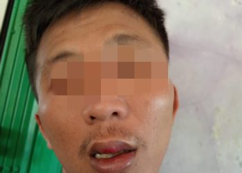 Viral, Warga Ciemas Sukabumi Diduga Jadi Korban Salah Tangkap Hingga Mendapat Kekerasan Fisik Dari Oknum Polisi