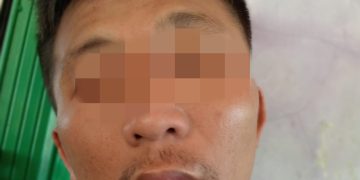 Viral, Warga Ciemas Sukabumi Diduga Jadi Korban Salah Tangkap Hingga Mendapat Kekerasan Fisik Dari Oknum Polisi