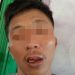 Viral, Warga Ciemas Sukabumi Diduga Jadi Korban Salah Tangkap Hingga Mendapat Kekerasan Fisik Dari Oknum Polisi