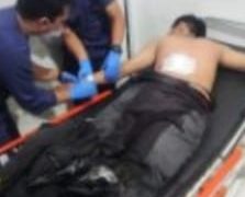 Perang Sarung di Kota Sukabumi Kembali Memakan Korban, Ini Kronologisnya